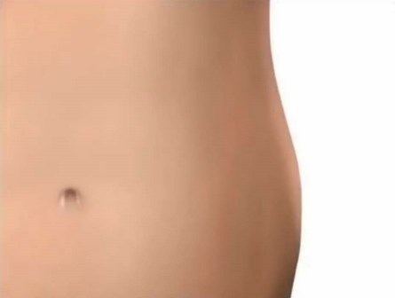 desenho de abdominem com gordura localizada